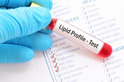 Lipid profile test
